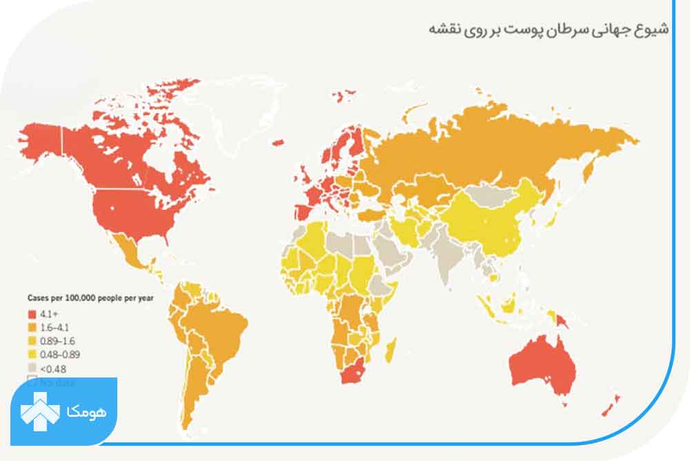 شیوع سرطان پوست