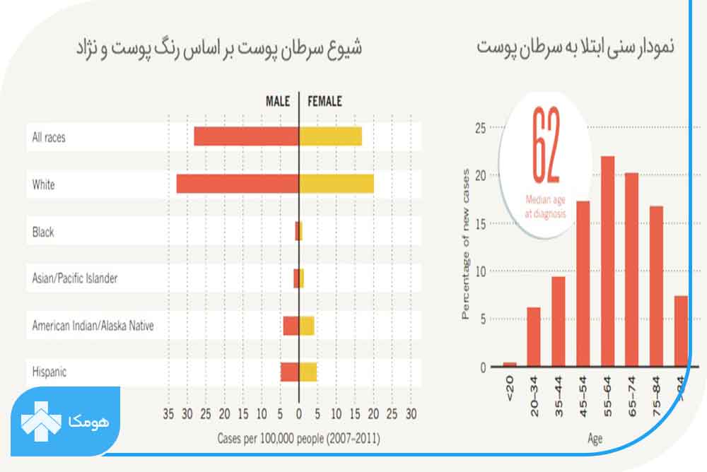 تاثیر سن و رنگ پوست بر سرطان پوست