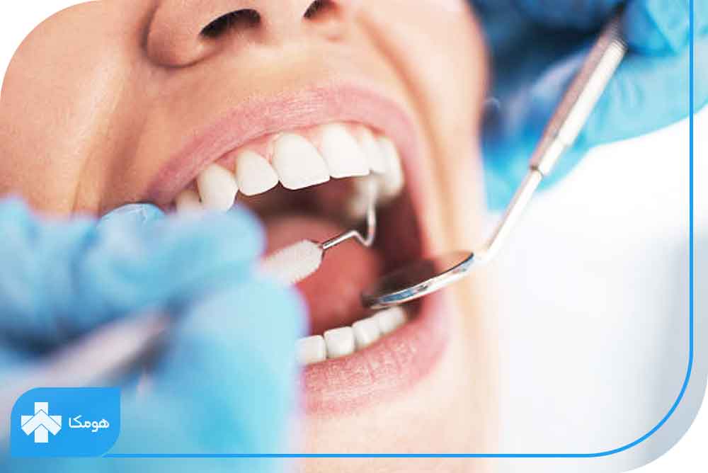 چرا بهداشت دهان و دندان در بیماران مبتلا به ام اس اهمیت دارد؟