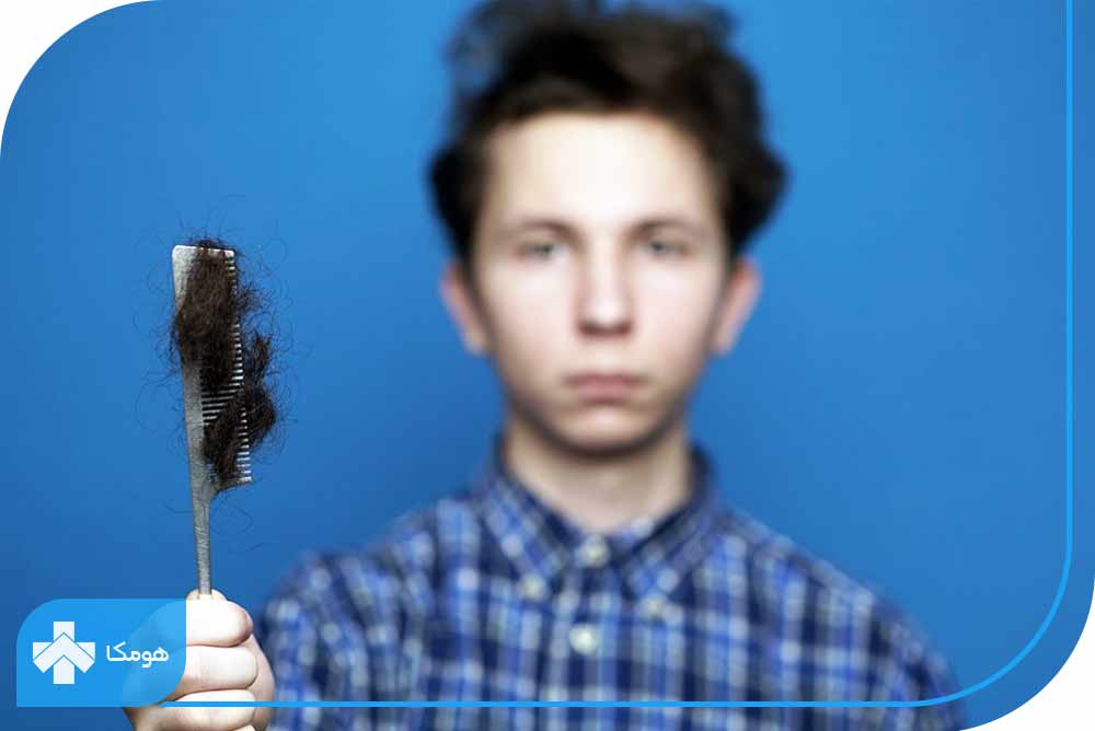 آیا بلوغ در ریزش موی نوجوانان تأثیر دارد؟