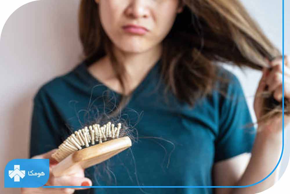 علت ریزش مو در نوجوانان