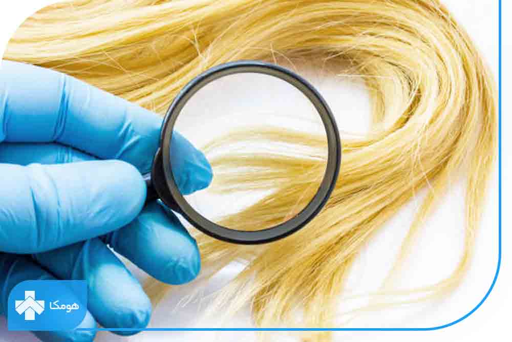 درمان ریزش مو در بارداری