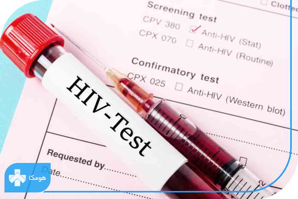 آزمایش بار ویروسی ایدز