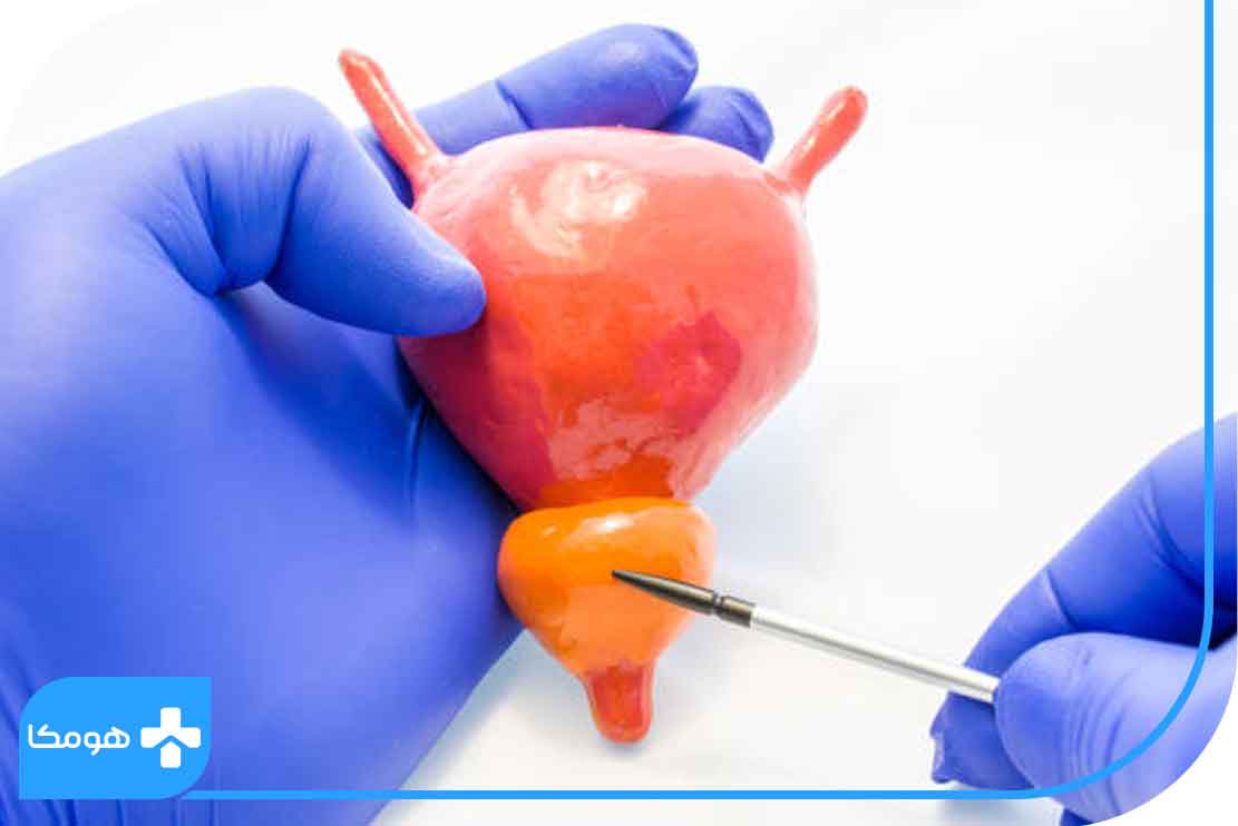 علائم التهاب پروستات چیست؟