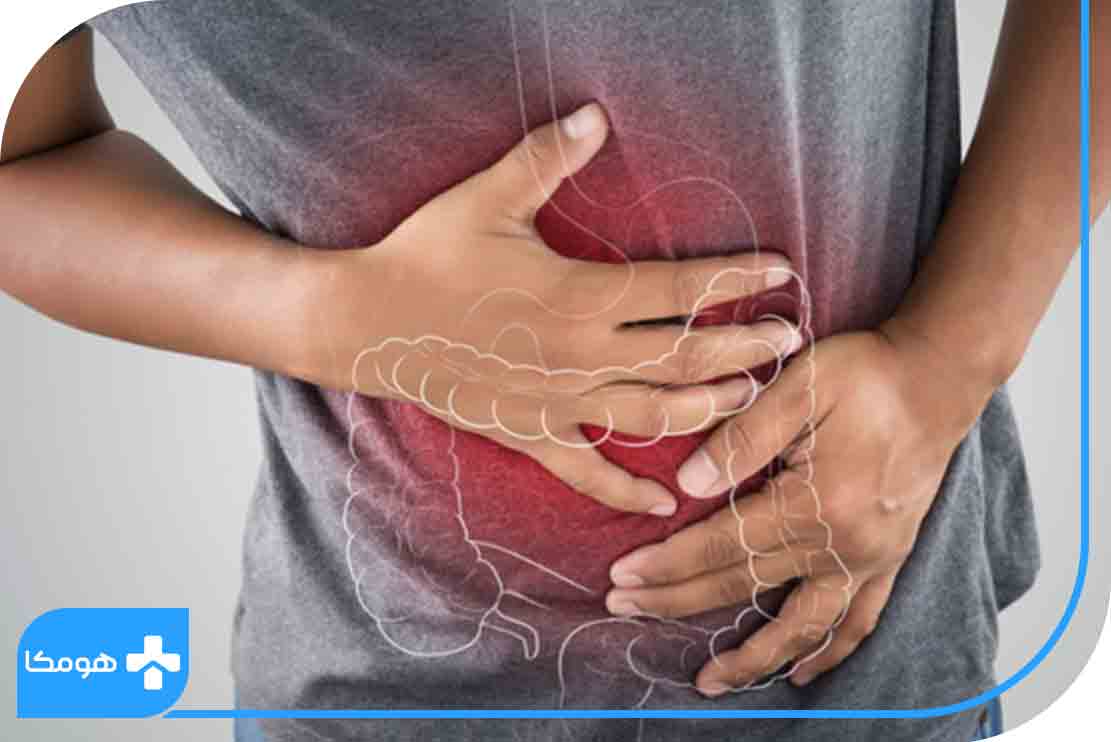 علائم سرطان روده پیشرفته