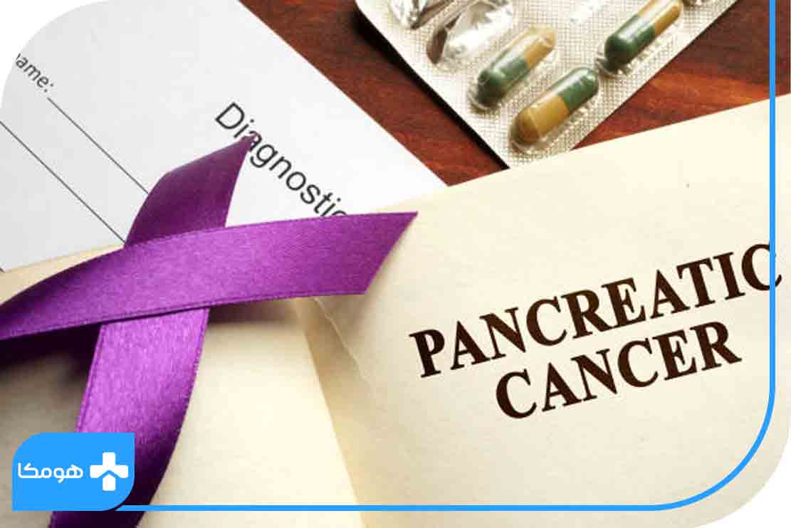 مراحل سرطان پانکراس