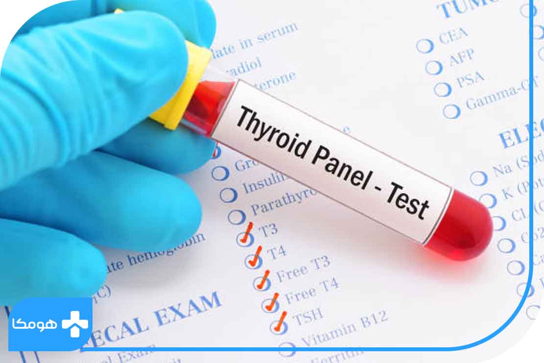 آزمایشات بعد از مصرف دوره‌ای لووتیروکسین