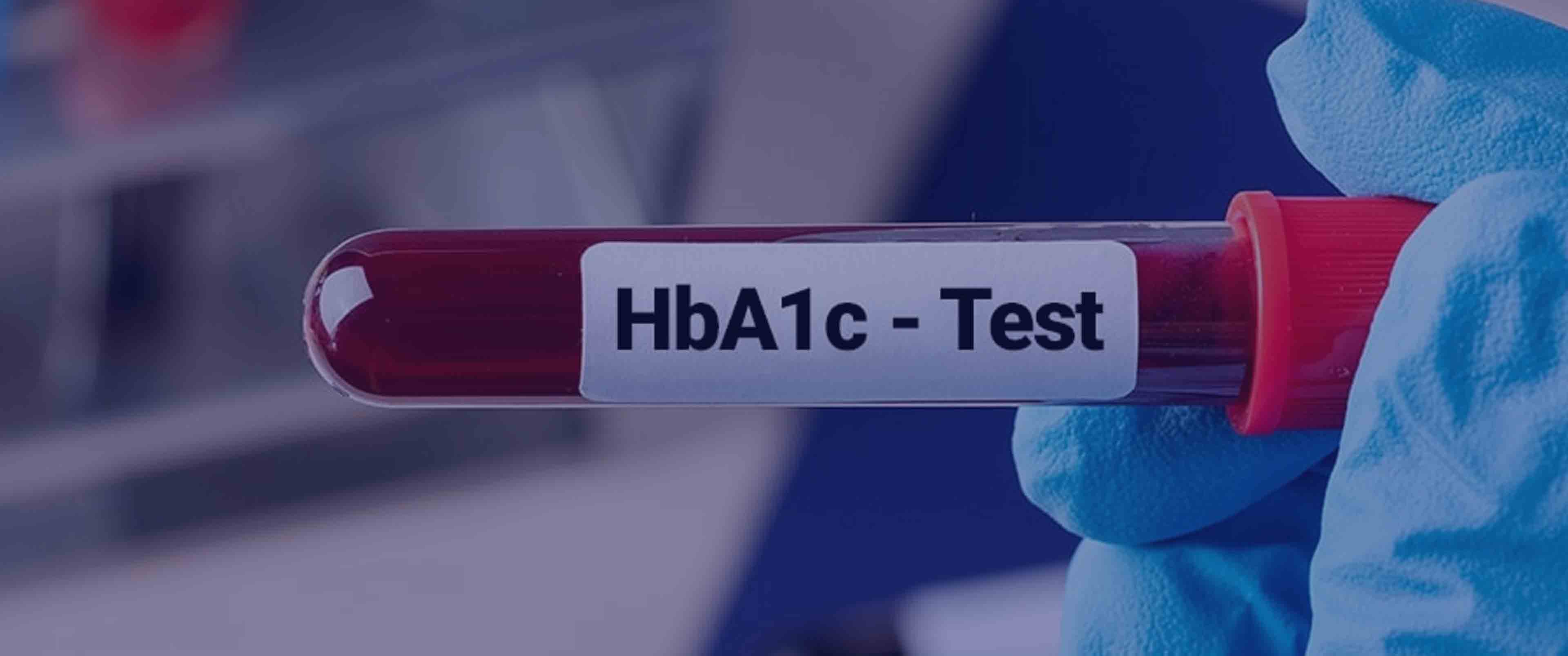 آزمایش HbA1C