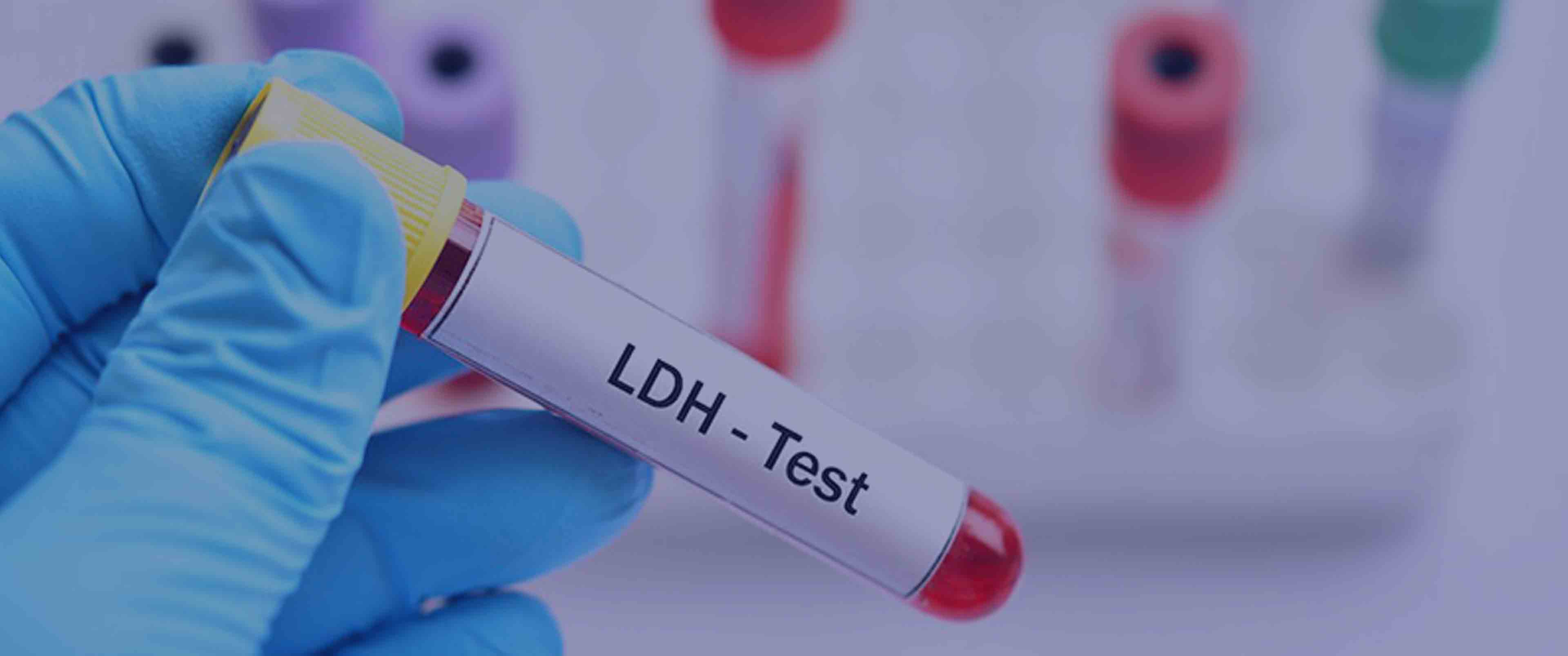 آزمایش LDH