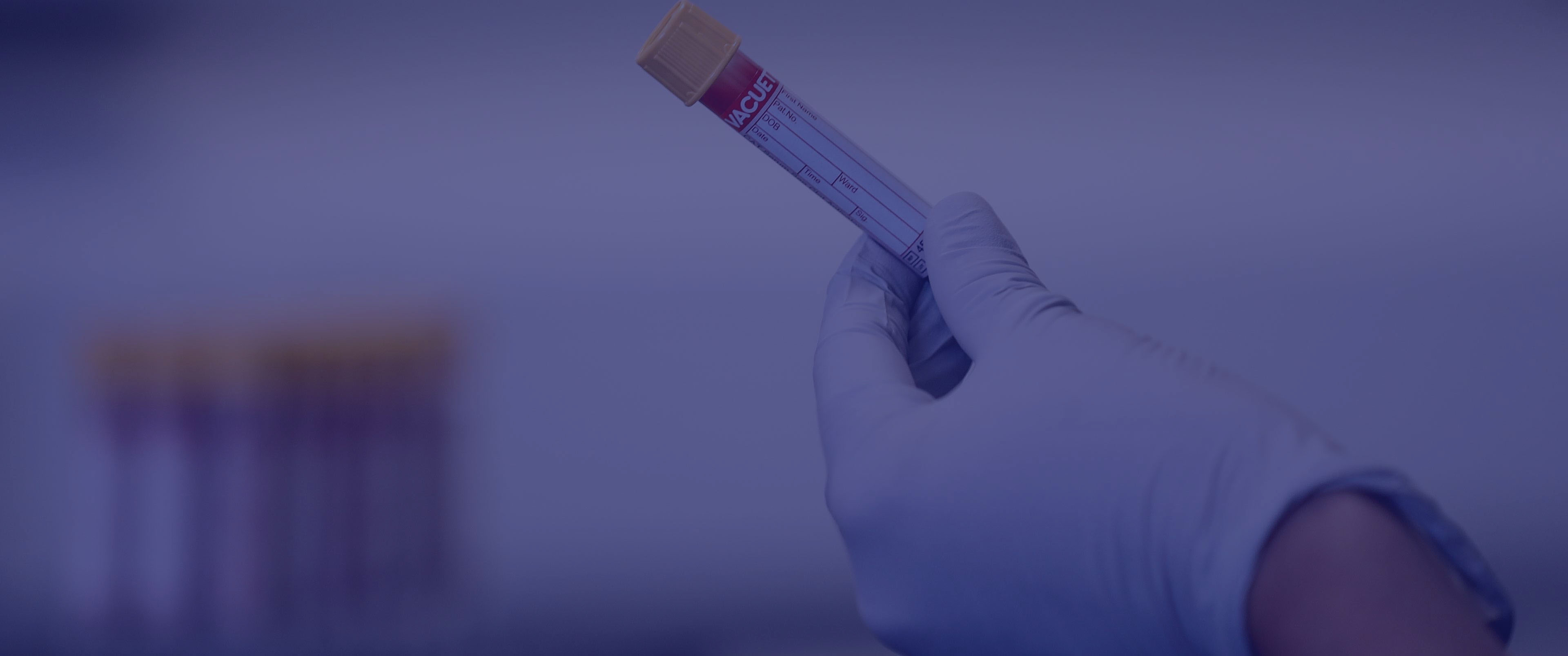 آزمایش Troponin