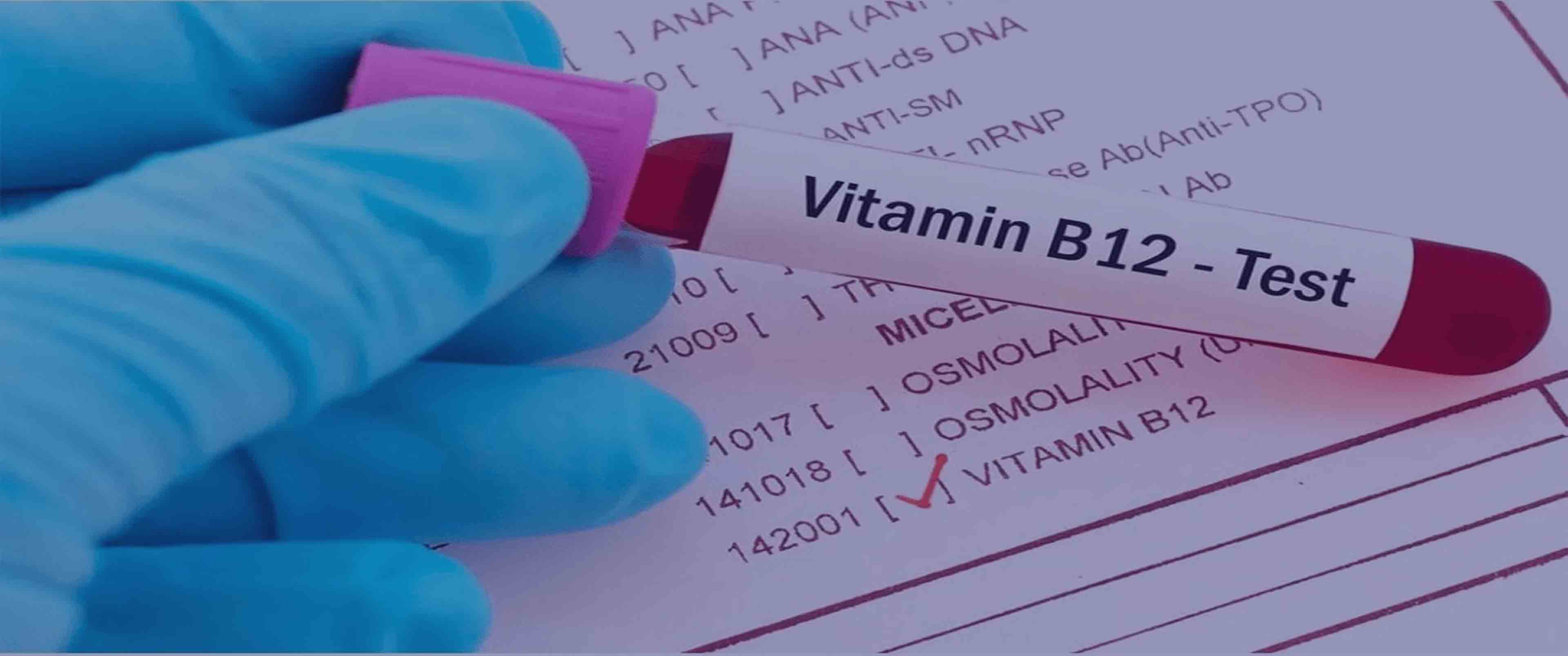 آزمایش ویتامین B12