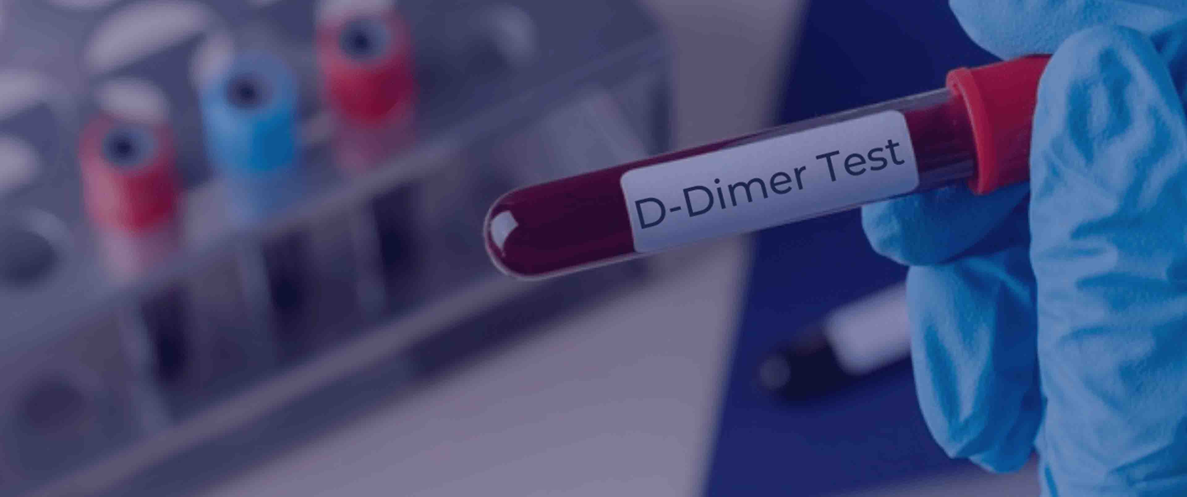 آزمایش D-dimer