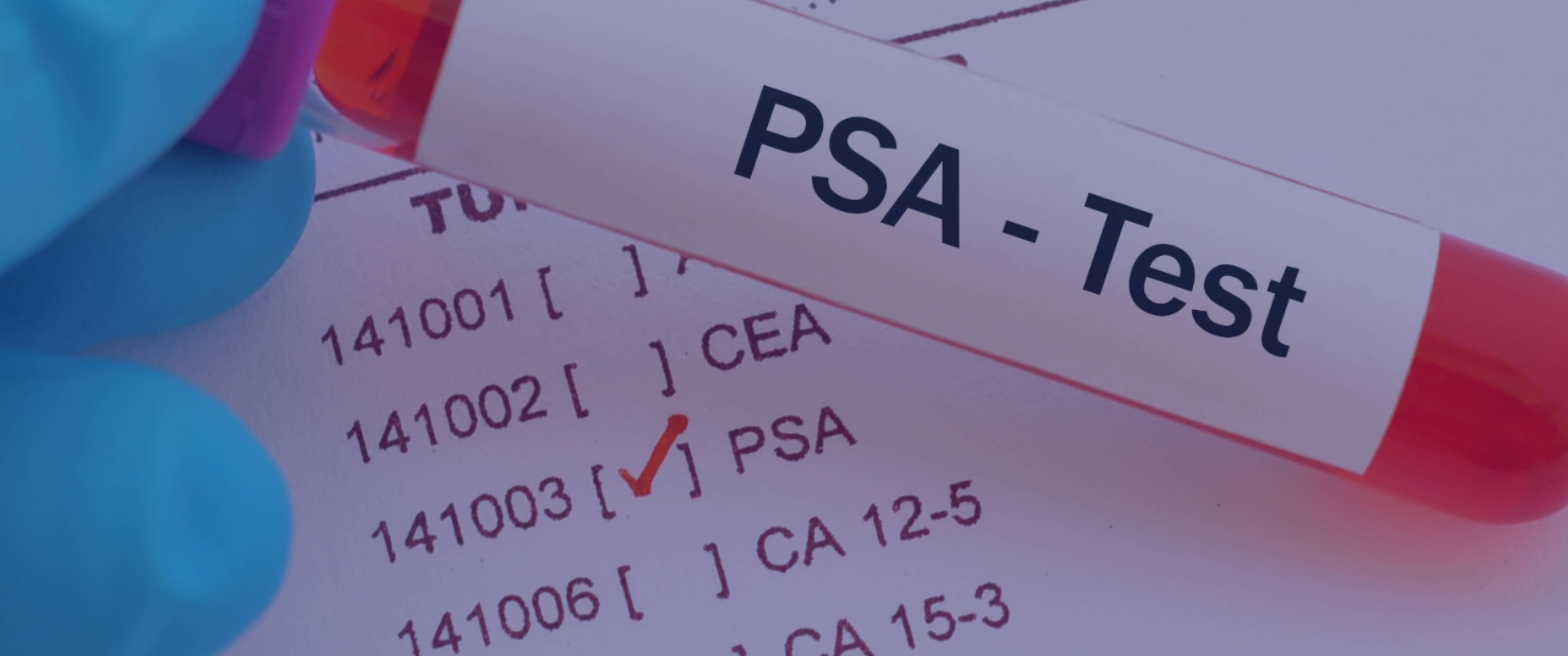 آزمایش PSA