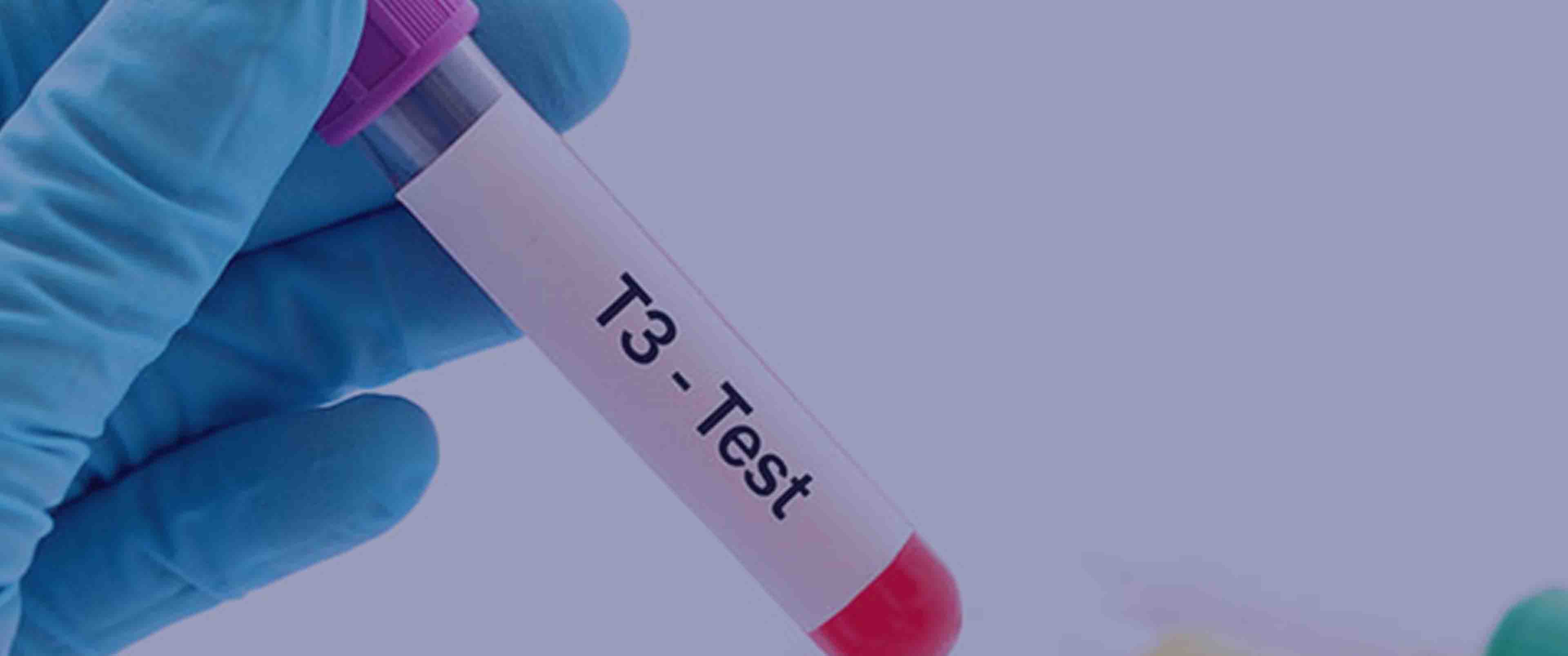 آزمایش T3