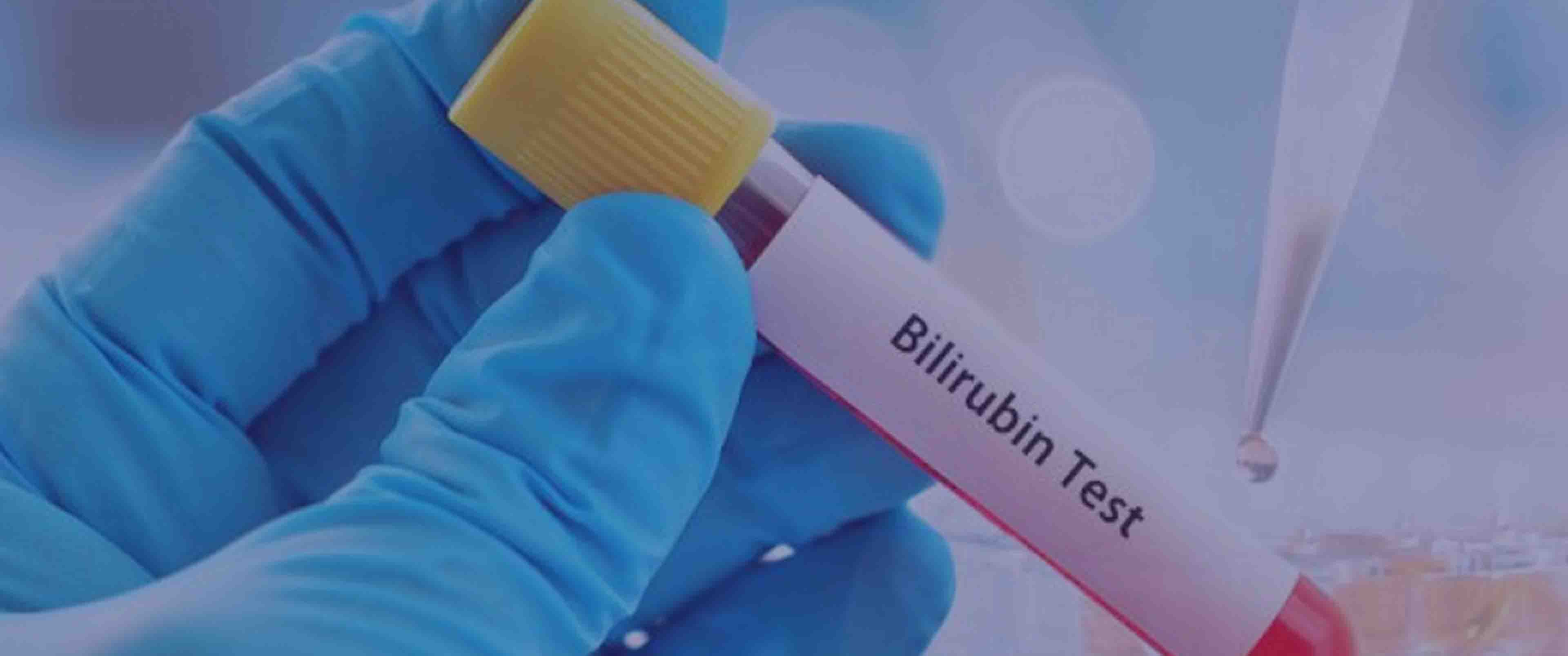 آزمایش Total Bilirubin