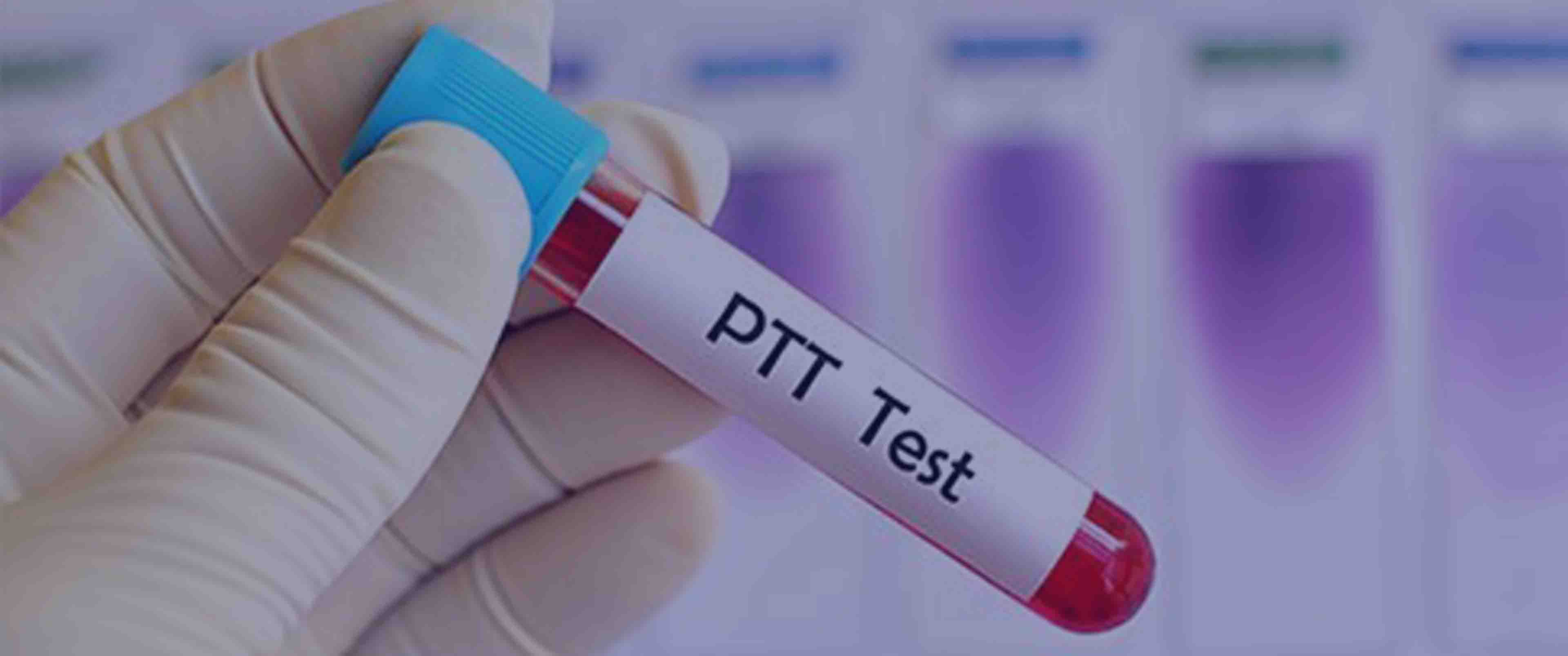 آزمایش PTT
