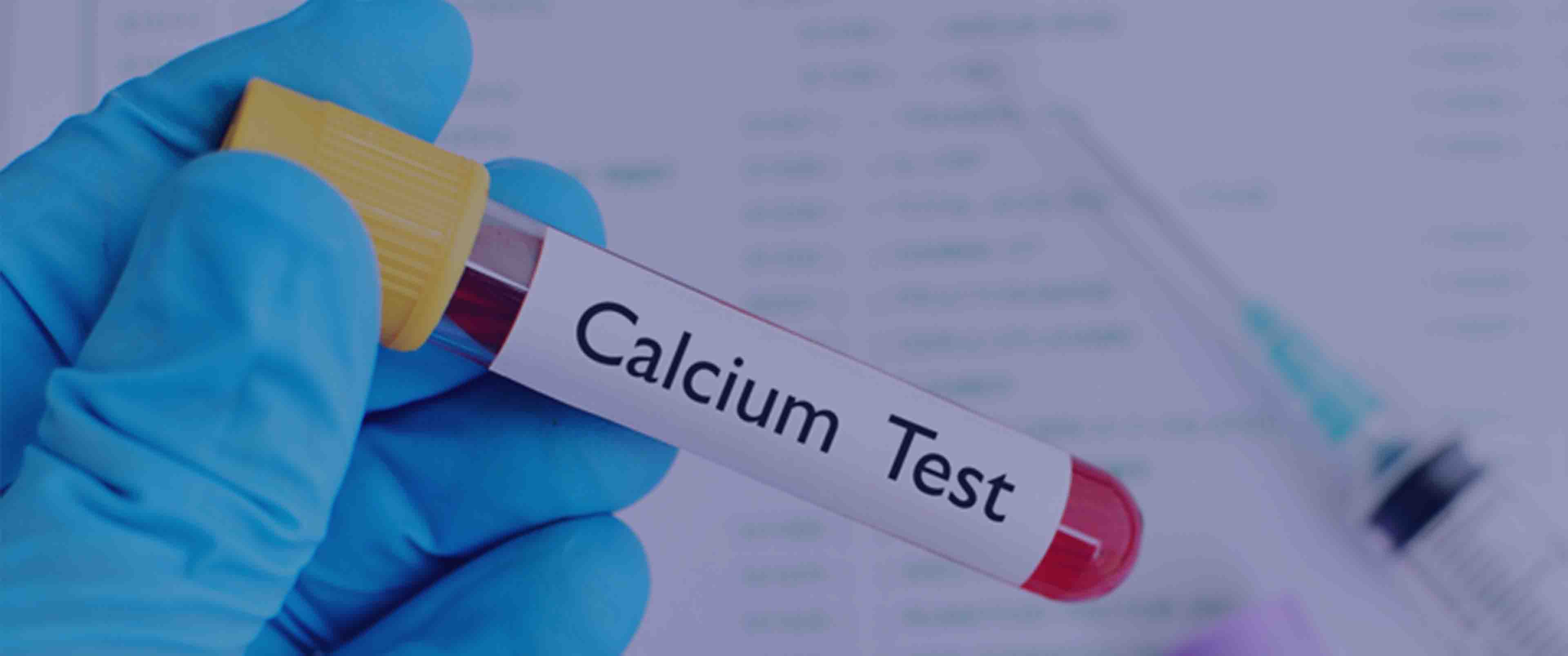 آزمایش Calcium