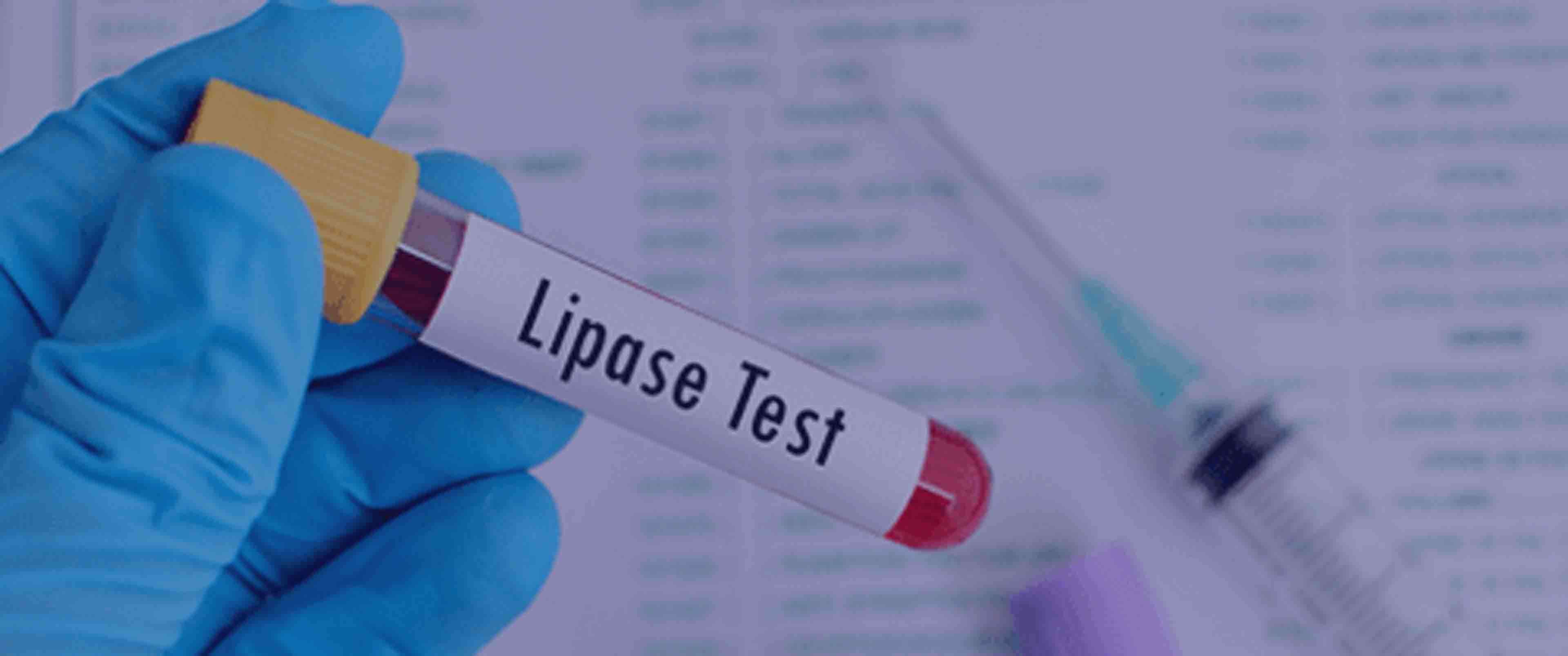 آزمایش Lipase