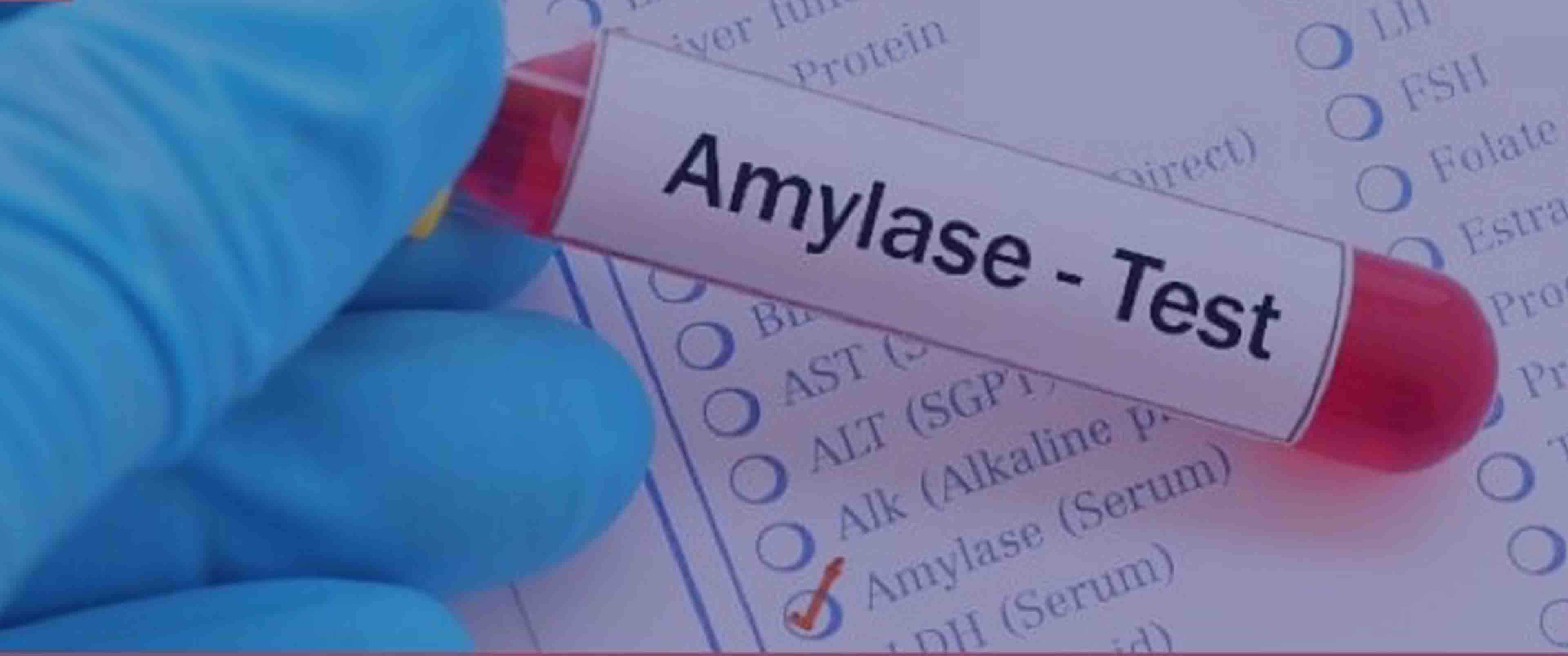 آزمایش Amylase
