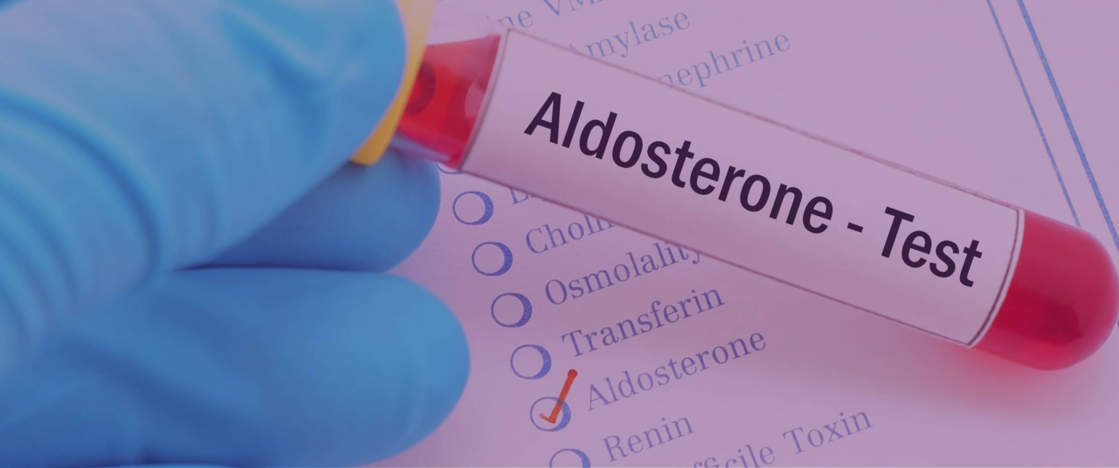 آزمایش Aldosterone