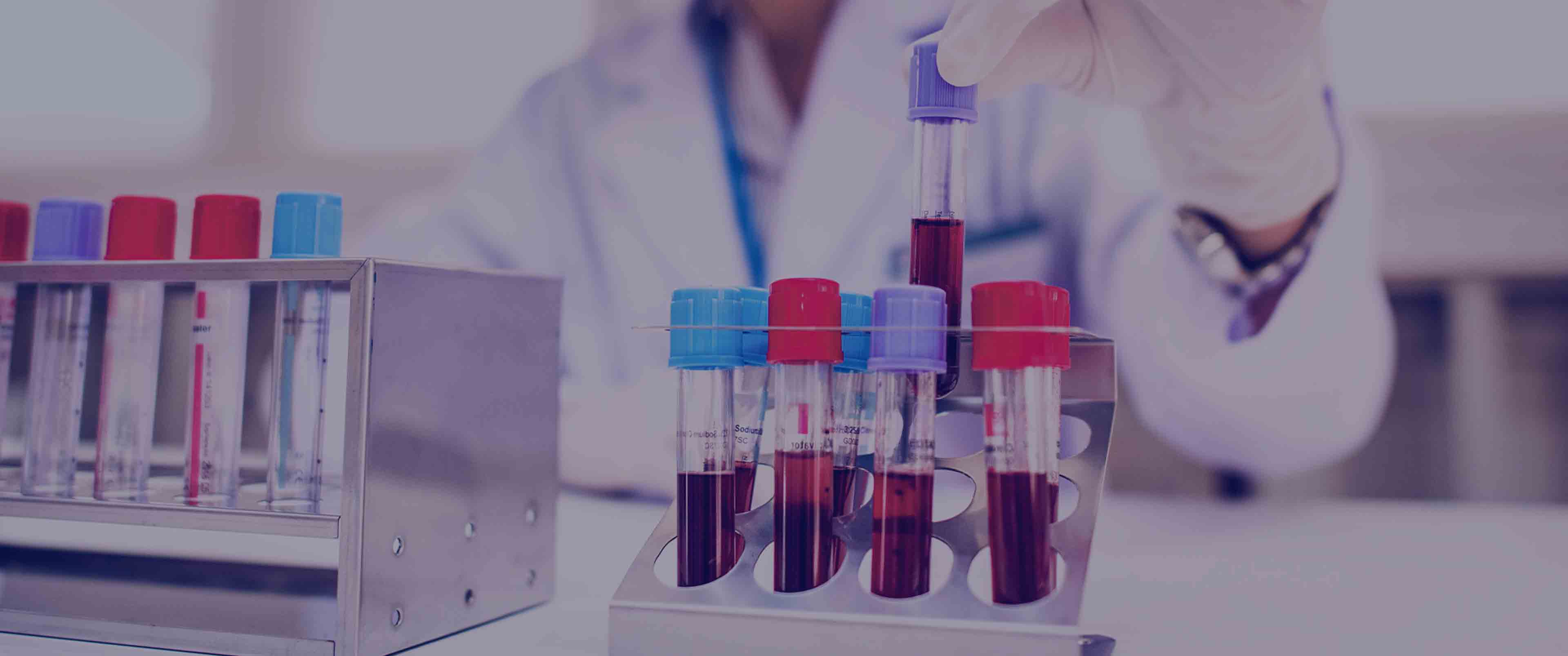 آزمایش Ferritin