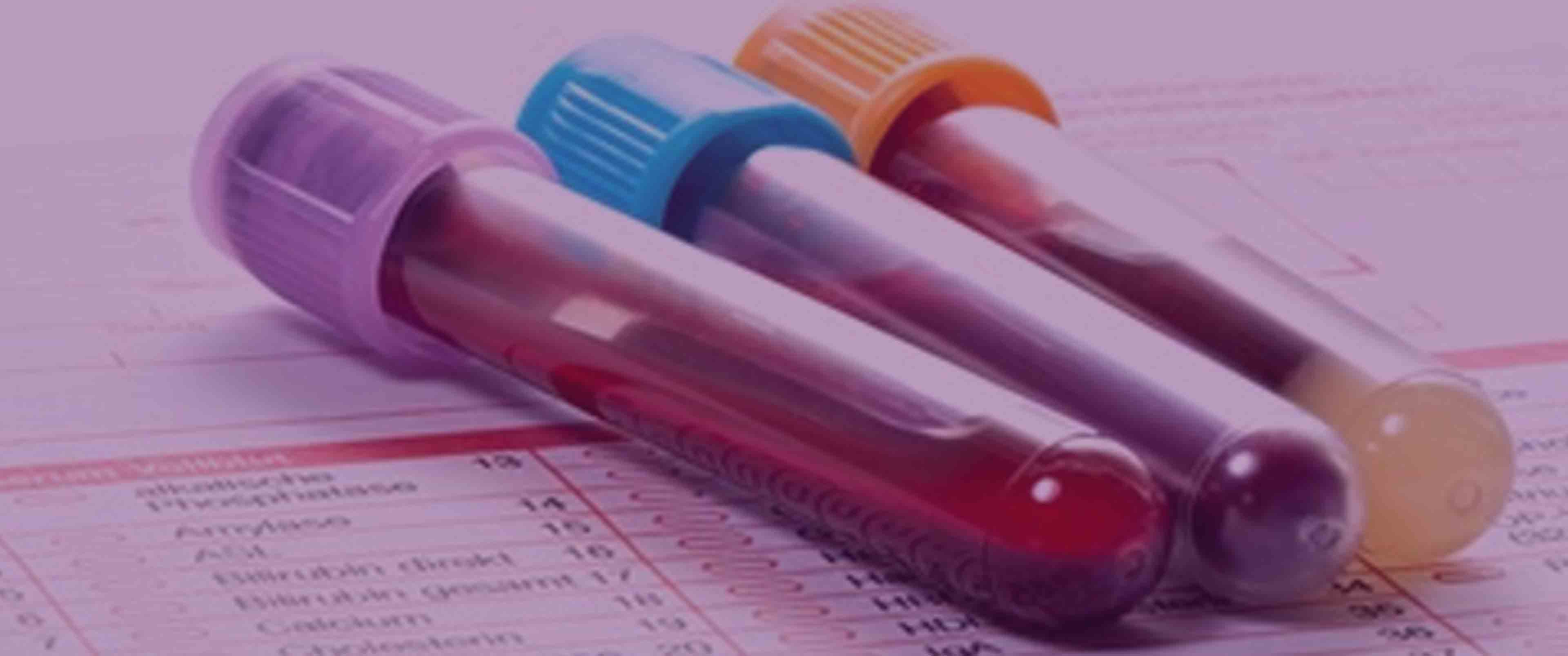 آزمایش هپاتیت