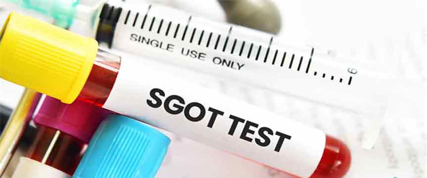 آزمایش SGOT یا AST