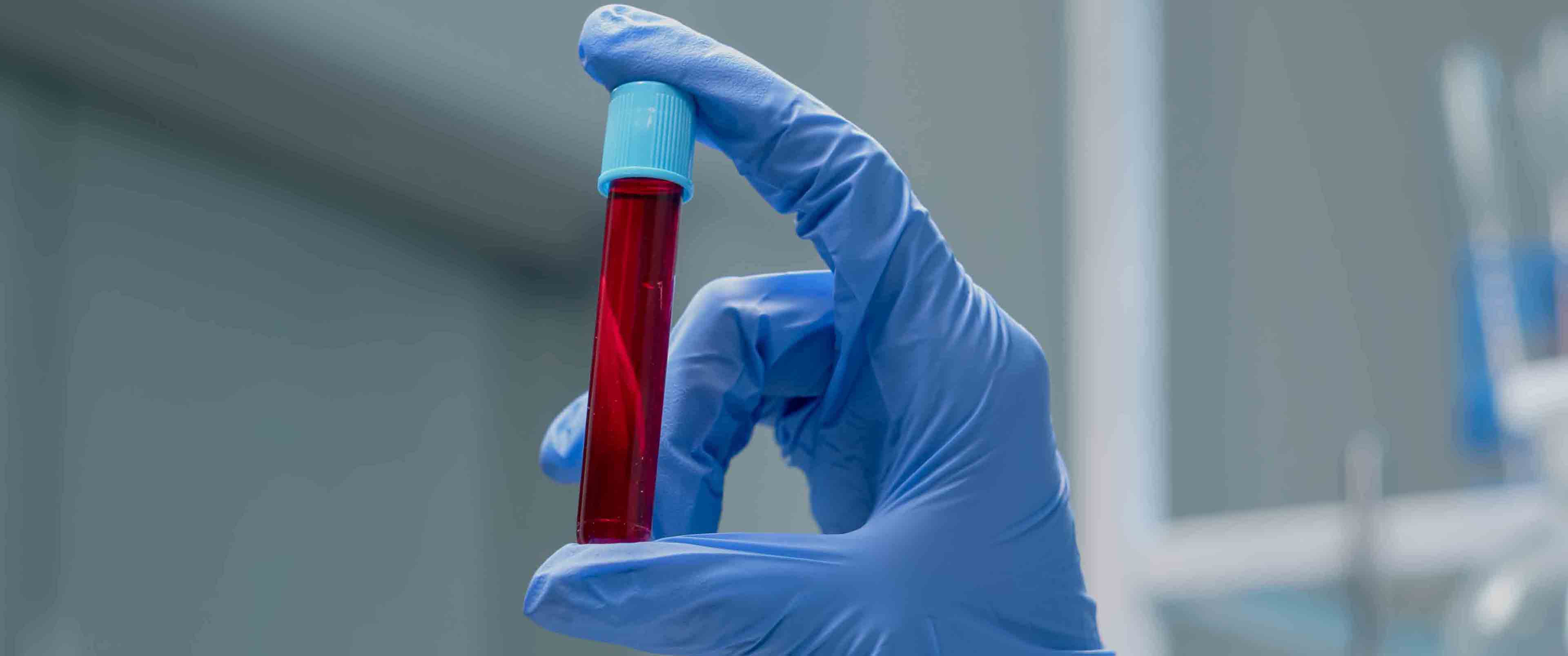 MCHC در آزمایش خون چیست؟
