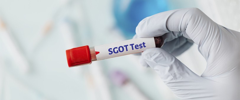 آزمایش SGOT (AST)