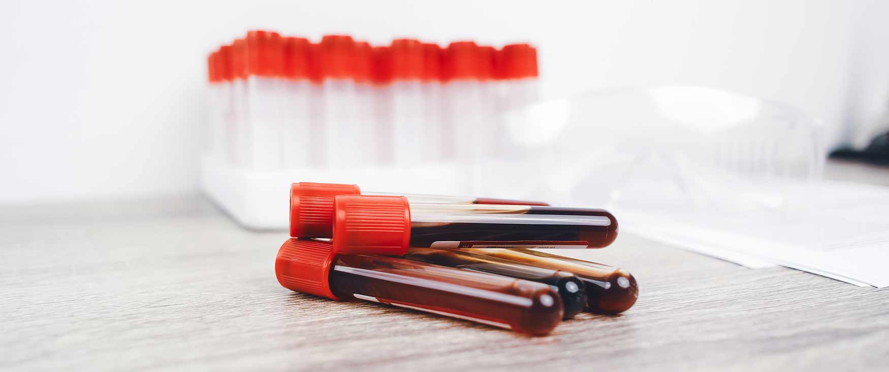 آزمایش RF RF و RF Titer در آزمایش خون هومکا