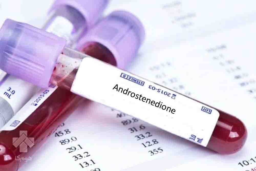 آزمایش Androstenedione