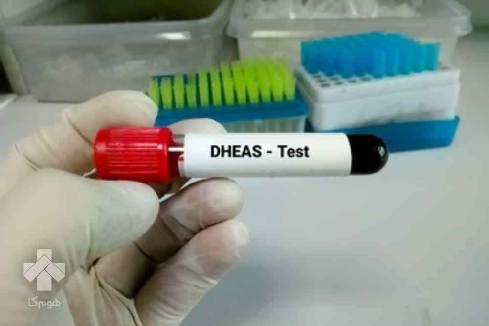 آزمایش DHEAs