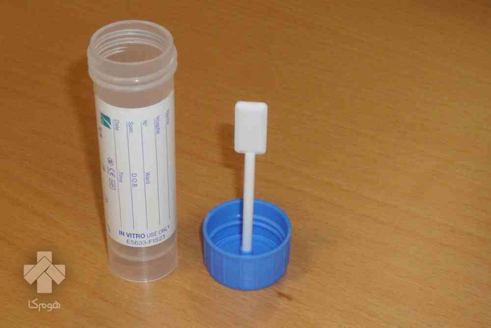 آزمایش H pylori Ag in stool