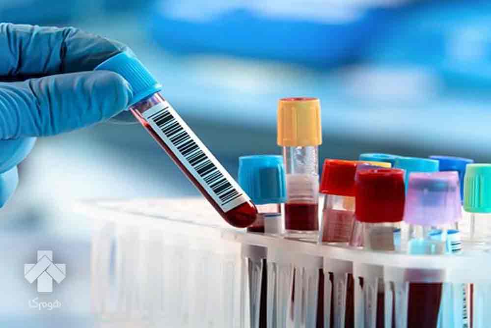 آزمایشگاه در آزادی