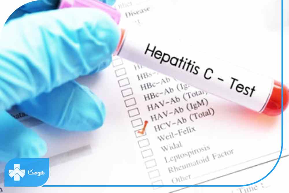  آزمایش HCV