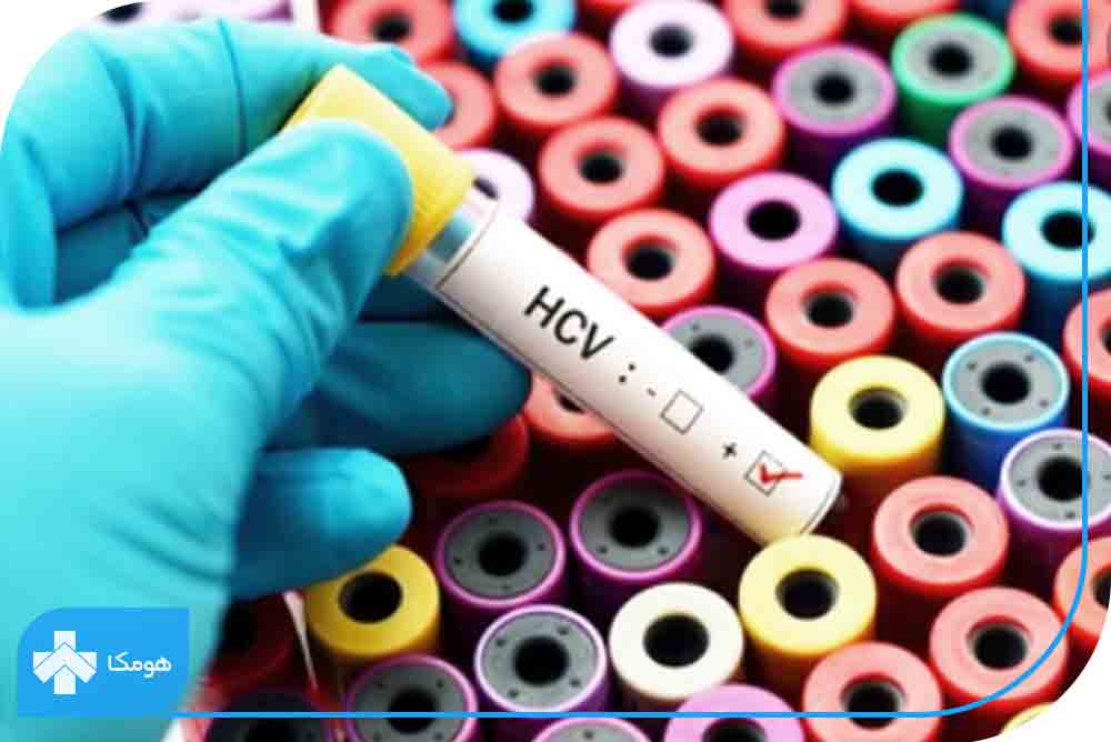 آزمایش HCV