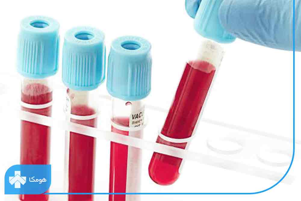 تفاوت MCH و MCHC در آزمایش خون