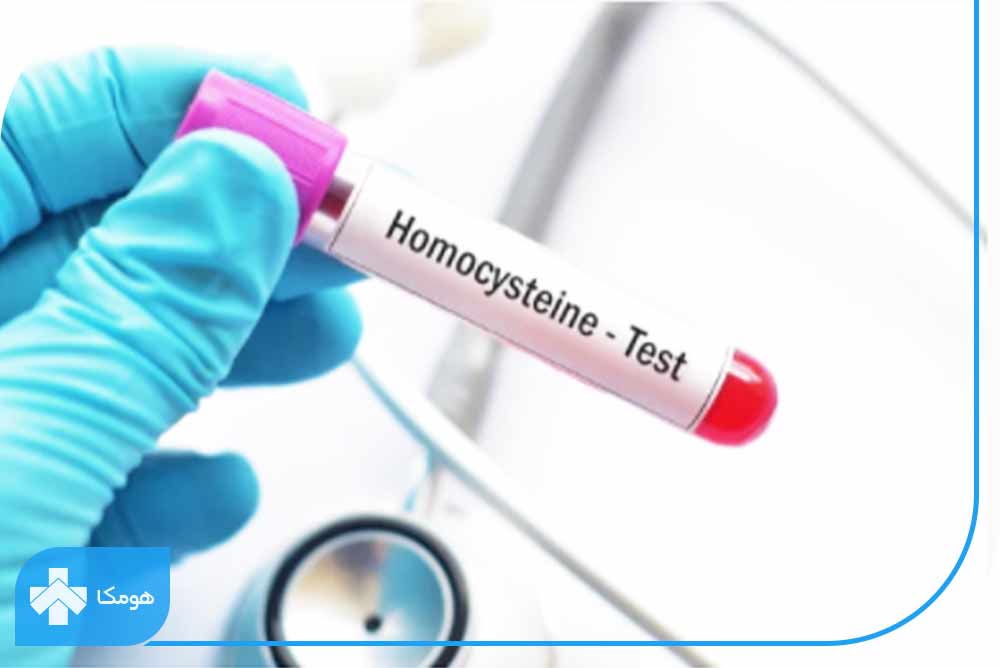آزمایش Homocysteine