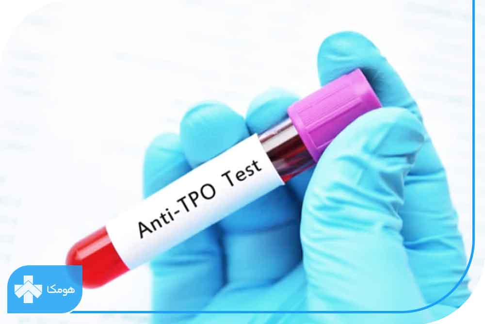 آزمایش anti tpo