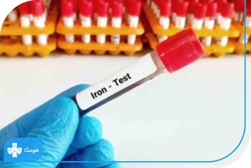 آزمایش آهن خون 