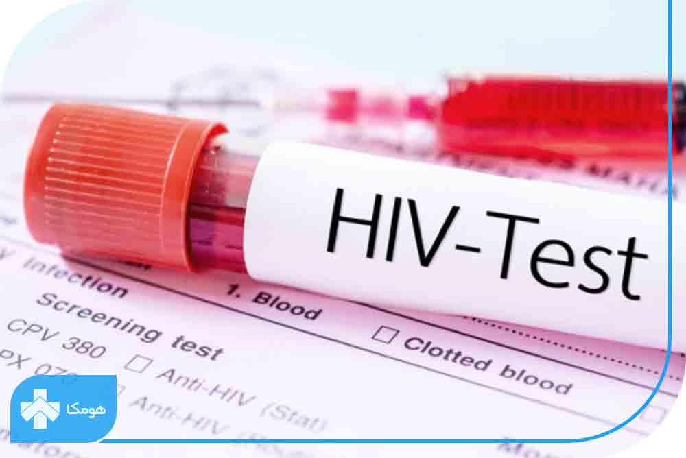آزمایش HIV ab