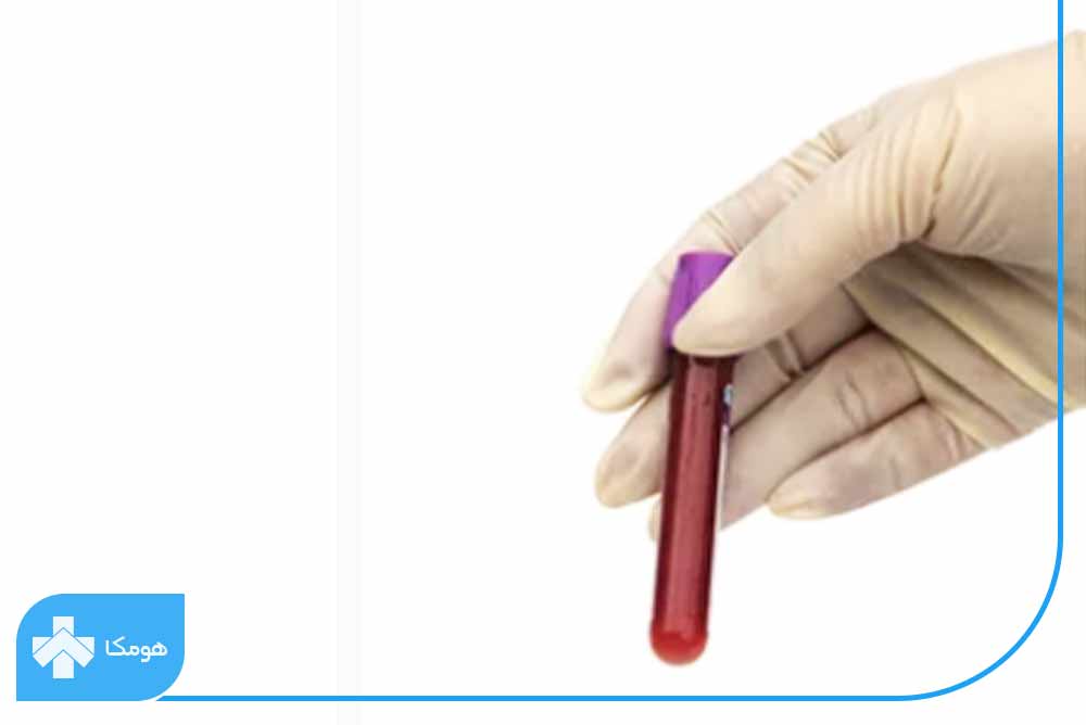 آزمایش Neutrophils چیست