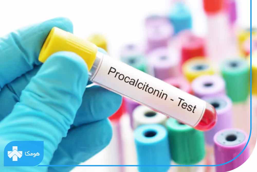 PCT در آزمایش خون چیست