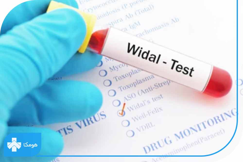  آزمایش Widal