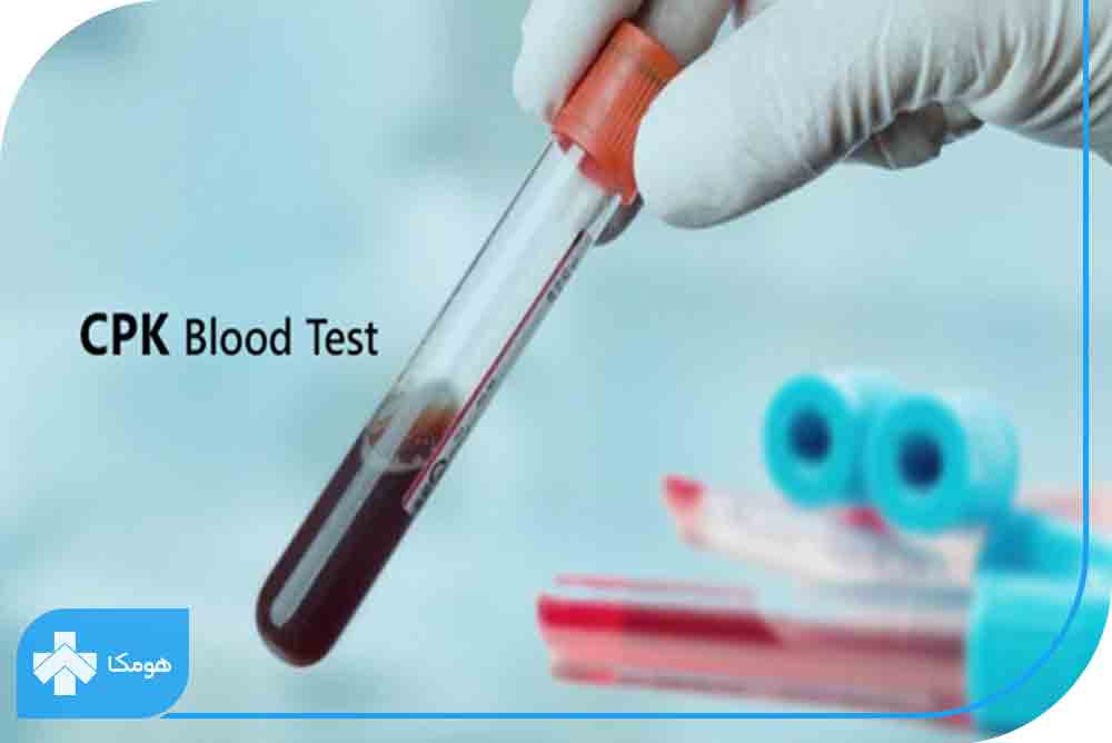 آزمایشات آنزیمی خون