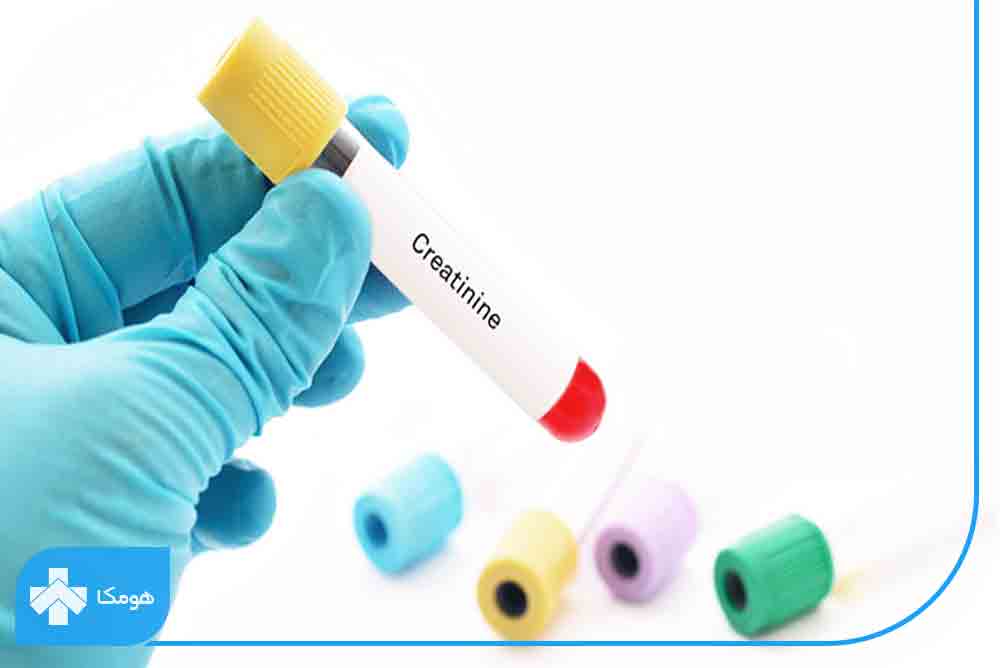 آزمایشات کلیه 