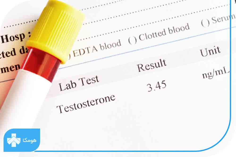 آزمایش تستوسترون
