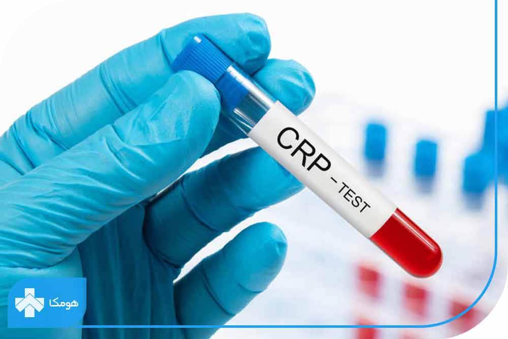 CRP در آزمایش خون چیست