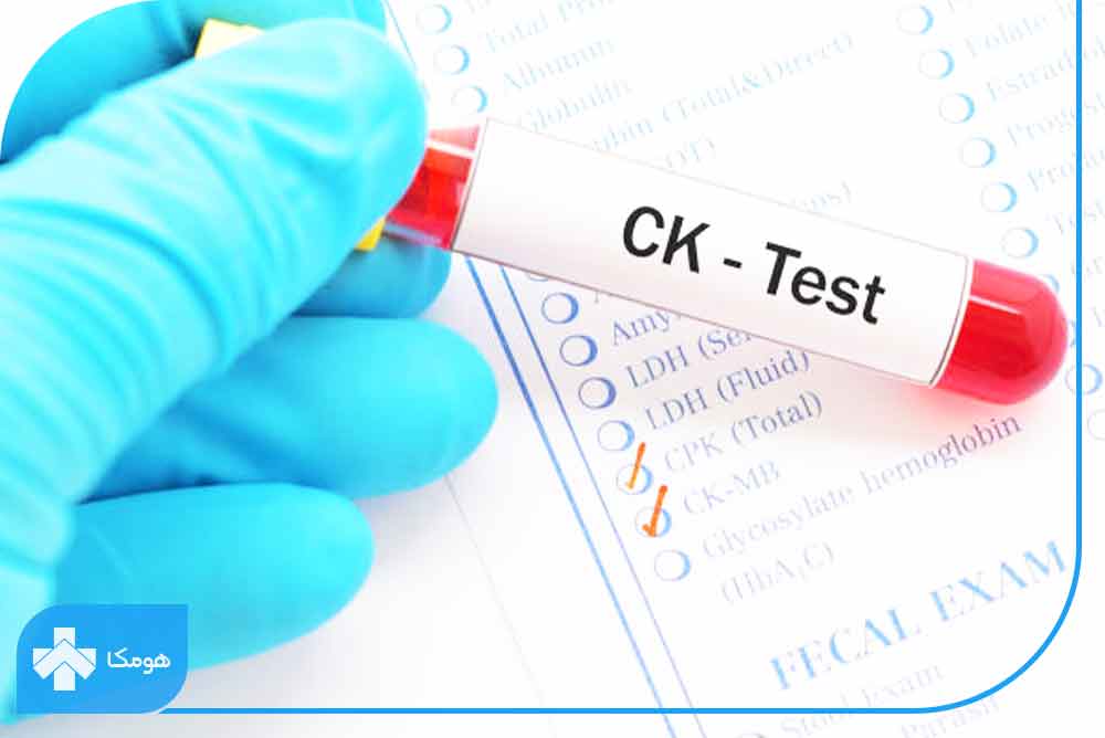 ck در آزمایش خون