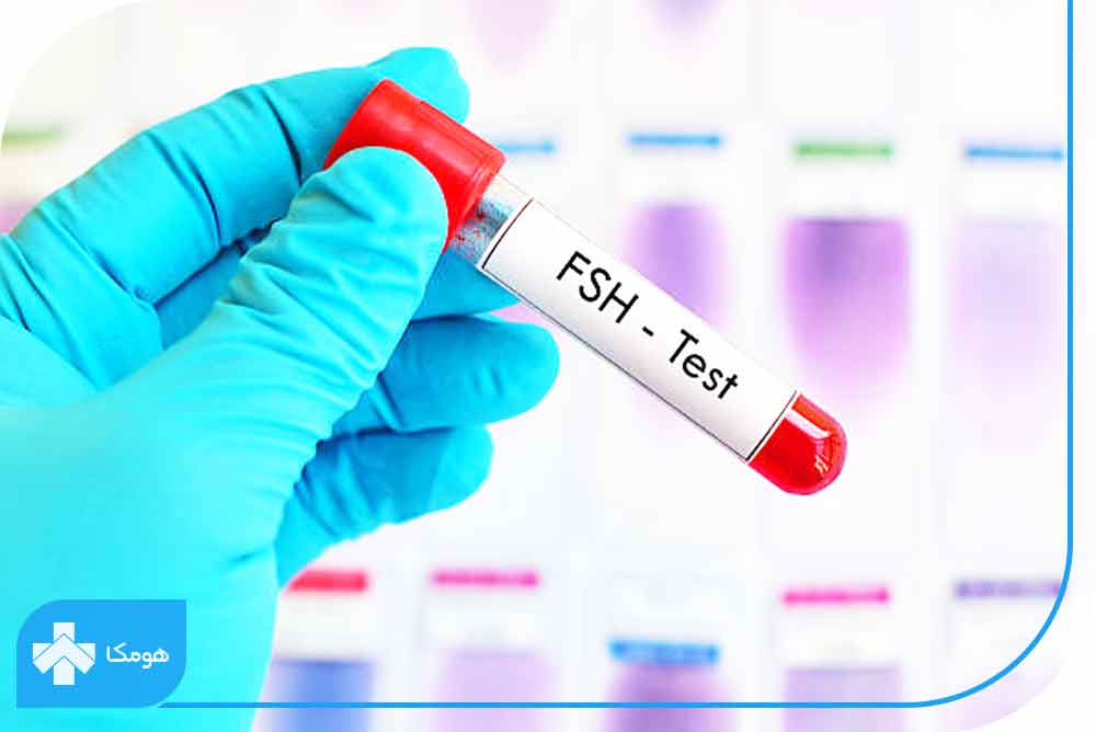 fsh در آزمایش خون